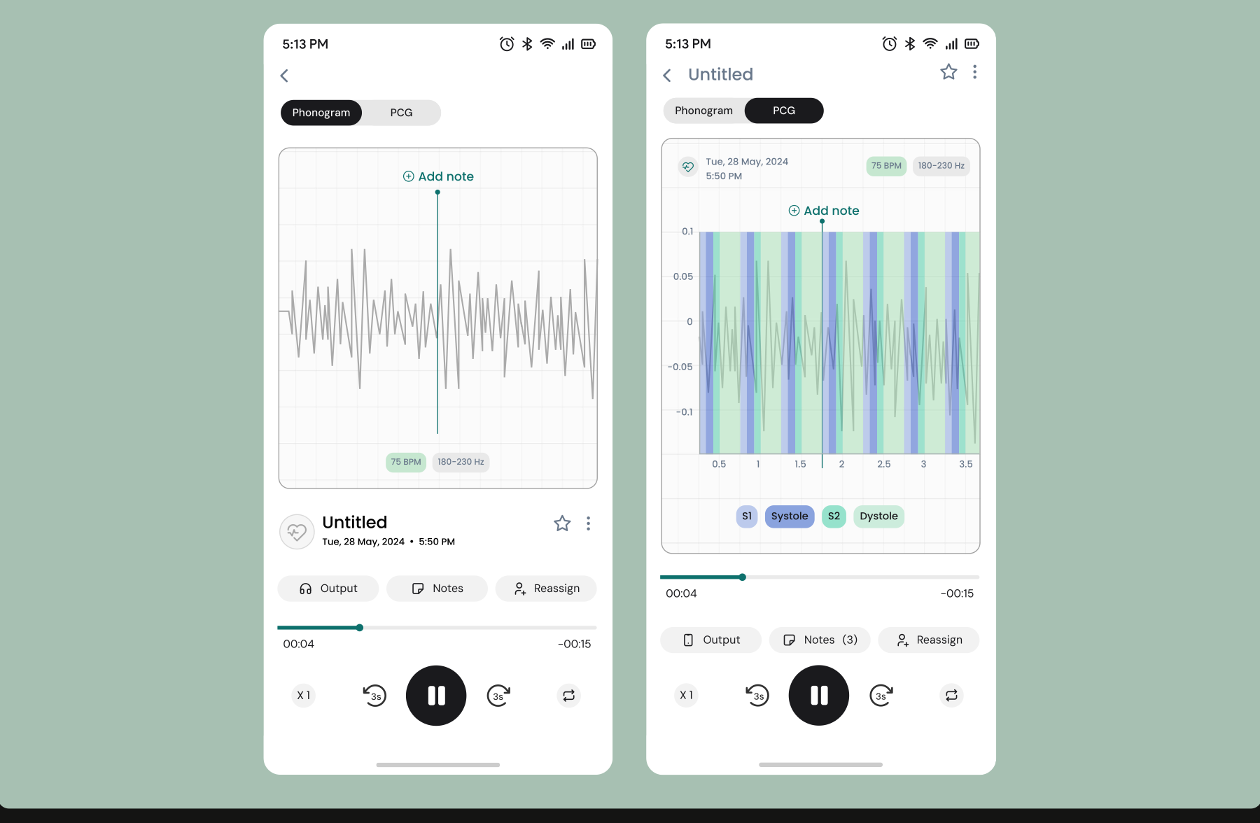 Playback with annotatable phonogram and PCG views
