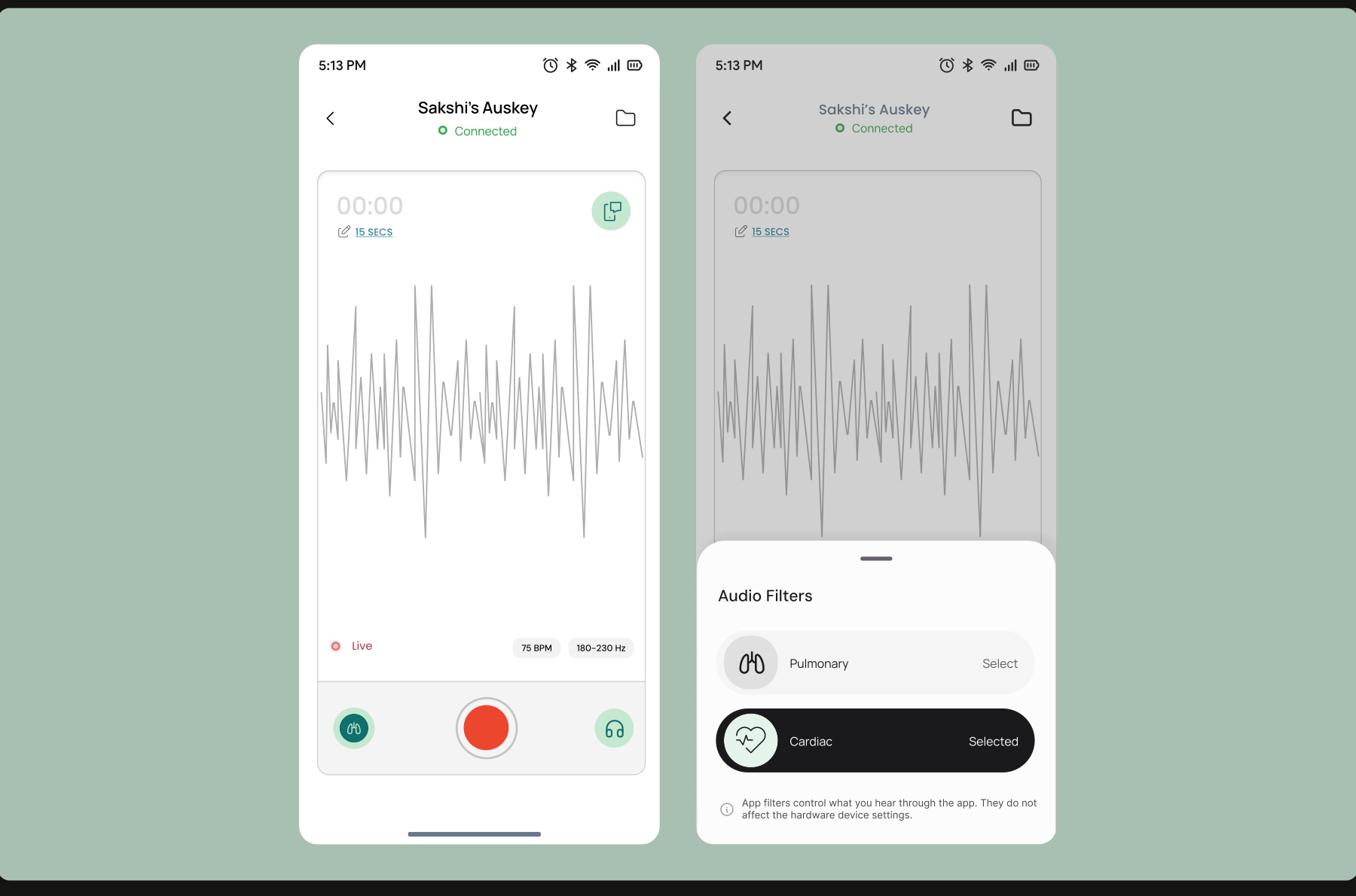 Recording screen with live waveform and pulmonary / cardiac audio filters